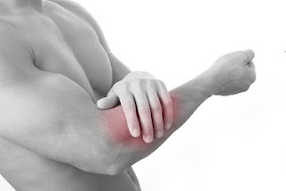 Tennis elbow